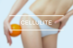 categorie-cellulite