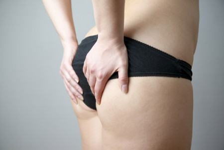 cellulite adipeuse