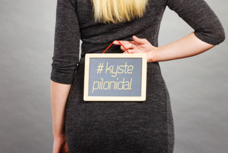 épilation laser et kyste pilonidal